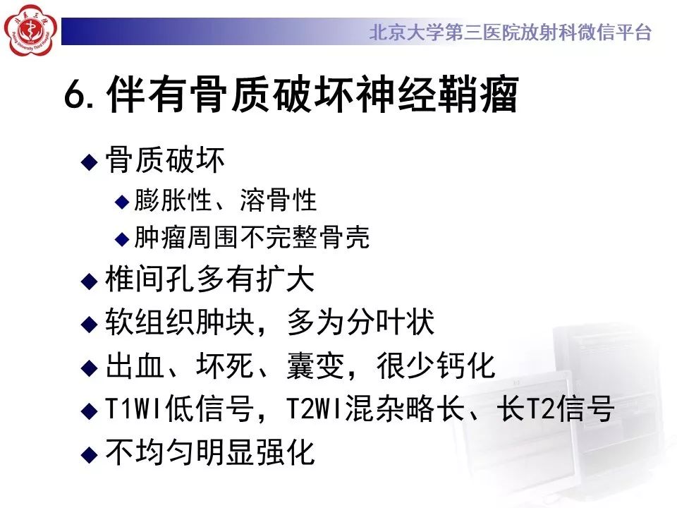 【病例】脊柱神经鞘瘤1例CT及MR