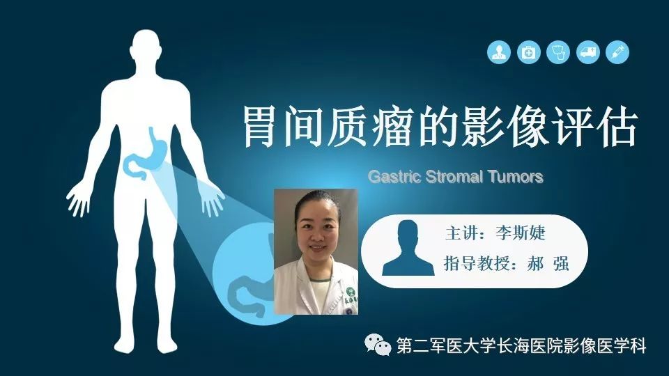 【PPT】胃间质瘤的影像评估