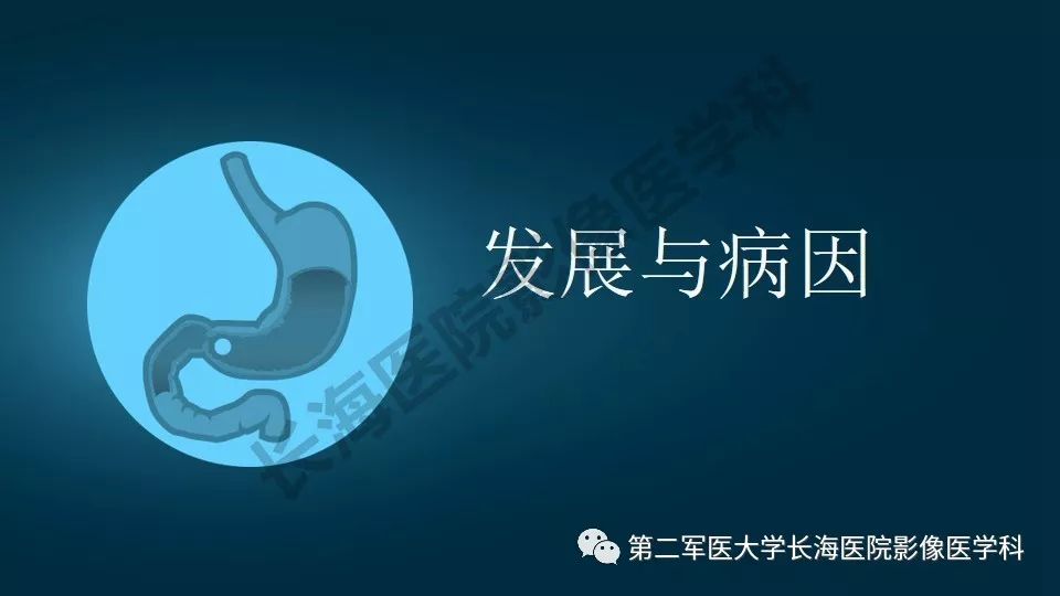 【PPT】胃间质瘤的影像评估