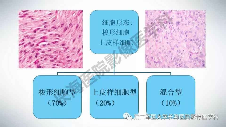 【PPT】胃间质瘤的影像评估