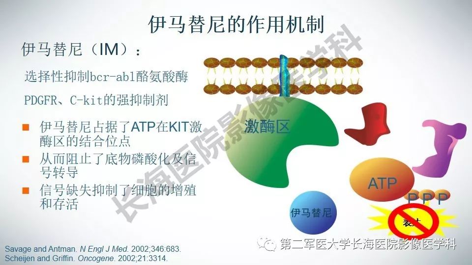 【PPT】胃间质瘤的影像评估