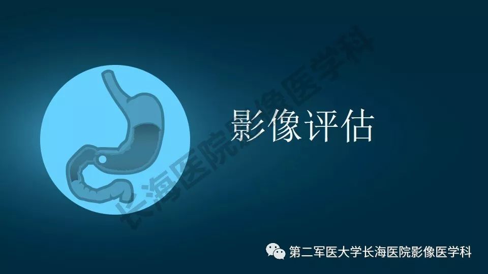 【PPT】胃间质瘤的影像评估