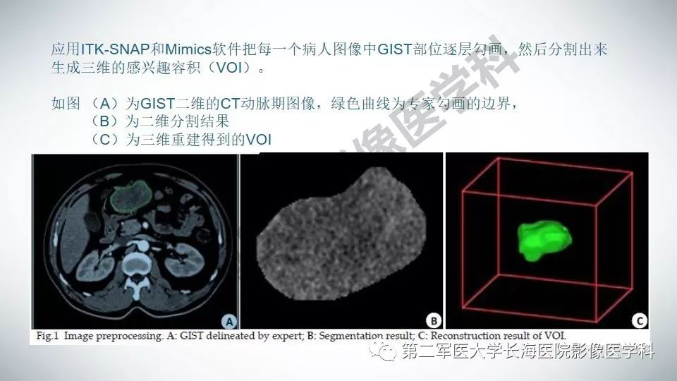 【PPT】胃间质瘤的影像评估
