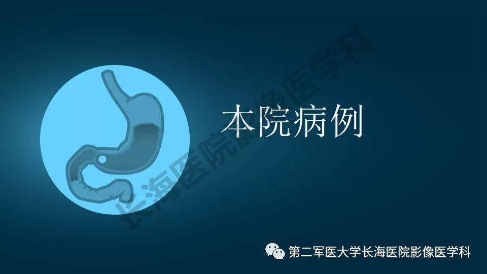 【PPT】胃间质瘤的影像评估