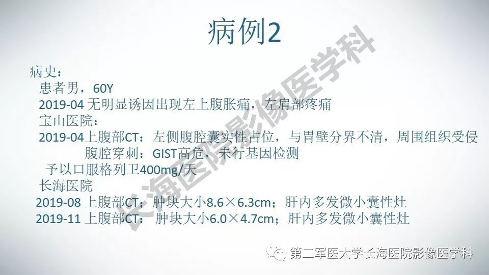 【PPT】胃间质瘤的影像评估