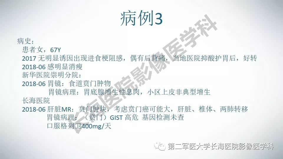 【PPT】胃间质瘤的影像评估