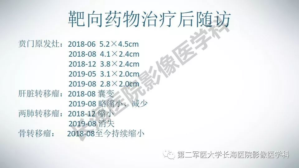 【PPT】胃间质瘤的影像评估