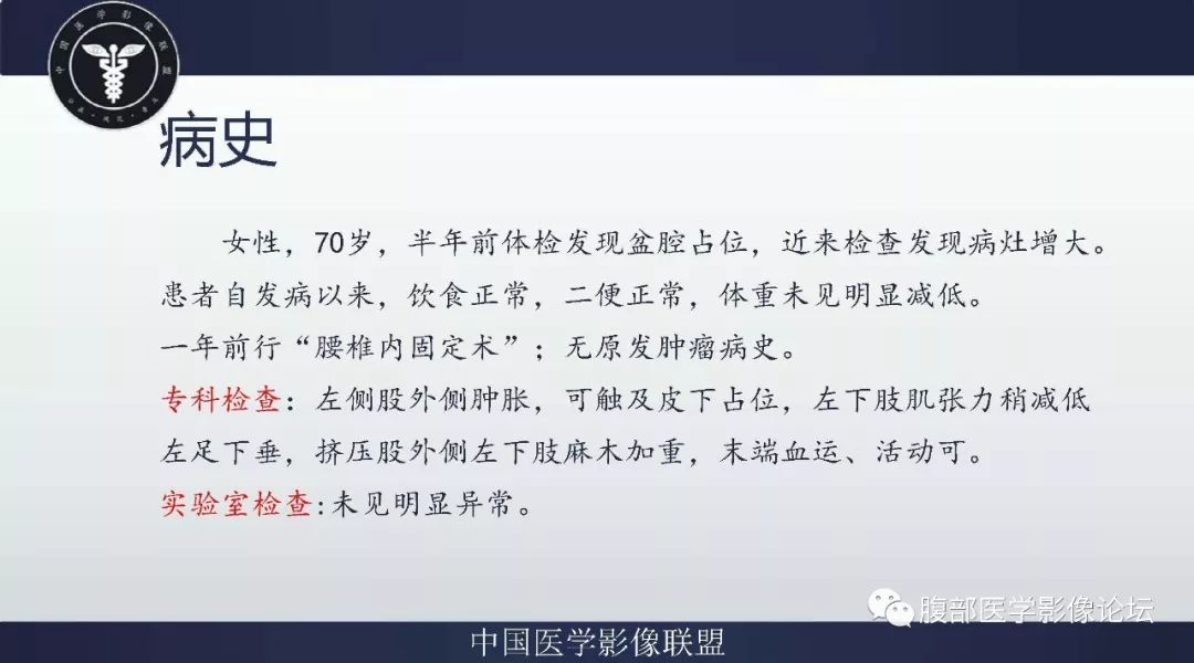 【病例】盆腔低级别去分化脂肪肉瘤1例CT及MR影像