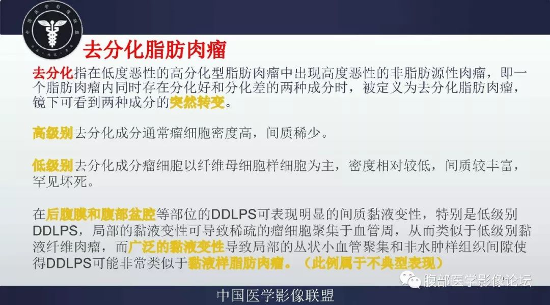 【病例】盆腔低级别去分化脂肪肉瘤1例CT及MR影像