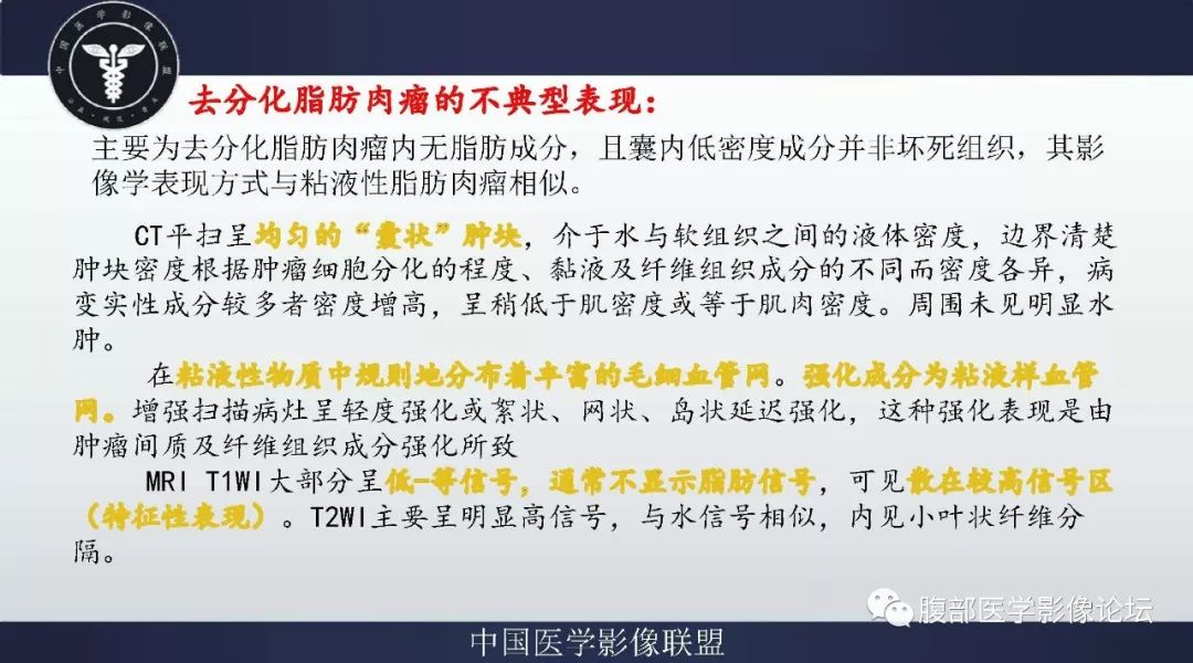 【病例】盆腔低级别去分化脂肪肉瘤1例CT及MR影像