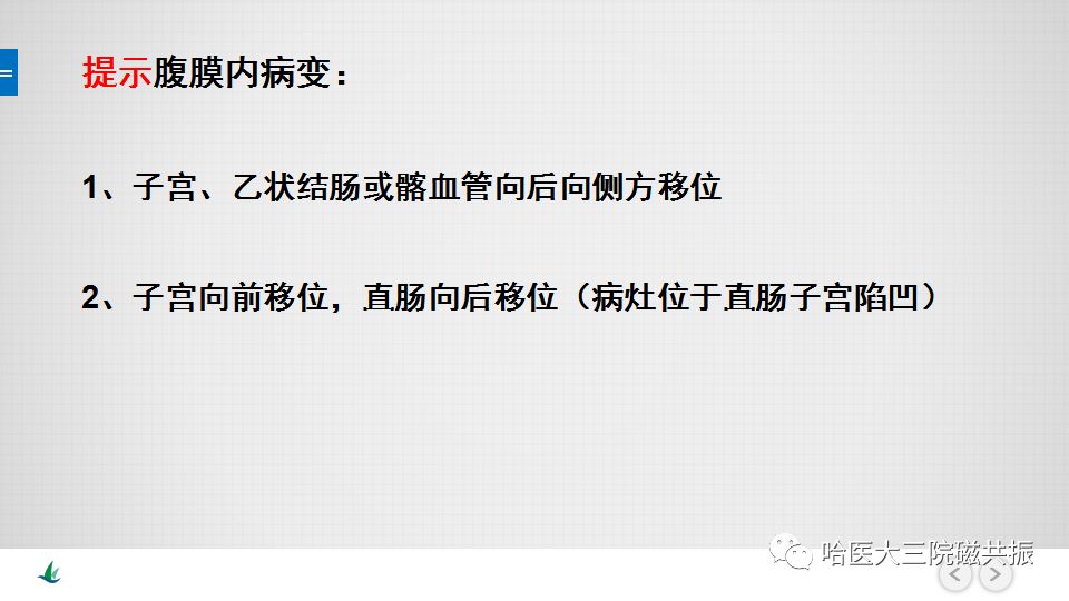 【PPT】女性盆腔肿瘤及肿瘤样变诊断思路分析—基于解剖位置