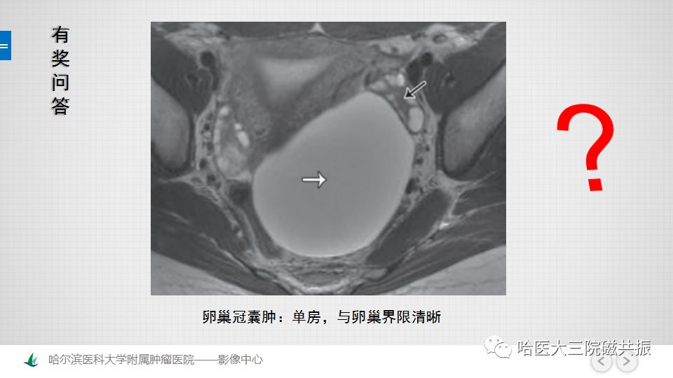 【PPT】女性盆腔肿瘤及肿瘤样变诊断思路分析—基于解剖位置