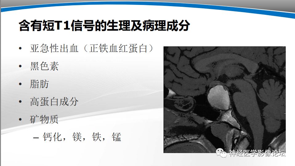 【PPT】颅内短T1信号的MRI鉴别诊断
