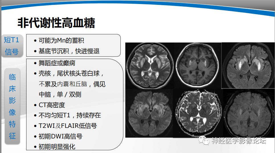 【PPT】颅内短T1信号的MRI鉴别诊断