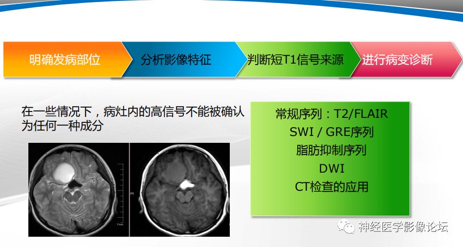 【PPT】颅内短T1信号的MRI鉴别诊断