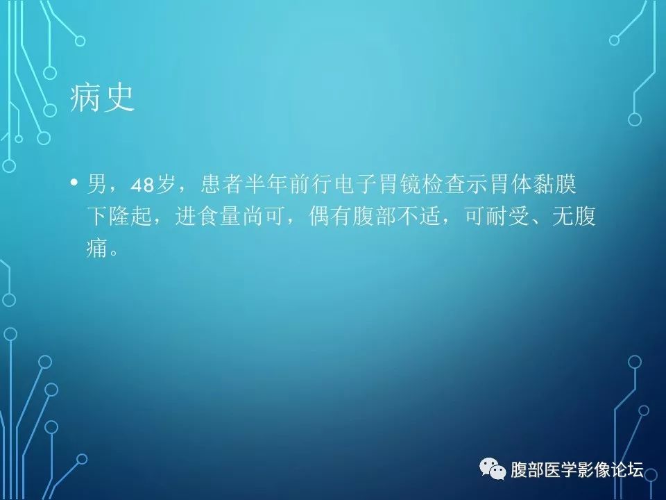 【病例】胃异位胰腺1例CT影像