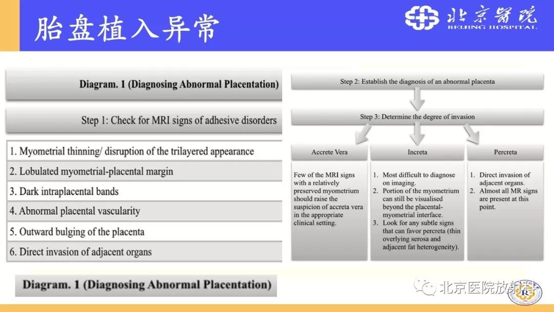 【PPT】胎盘从正常变异到植入异常与恶性肿瘤的MRI评估