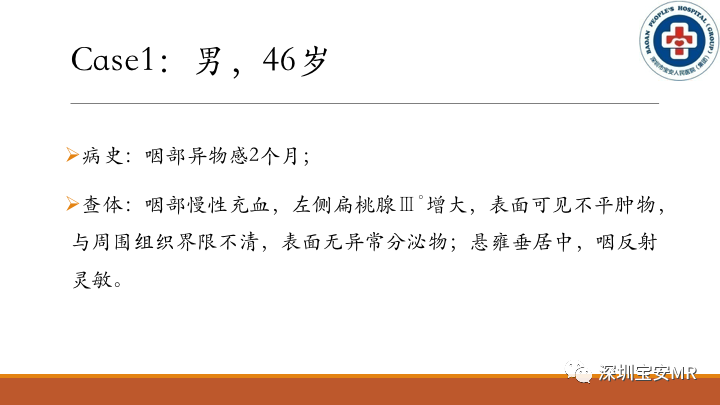 【病例】扁桃体淋巴瘤2例MR影像