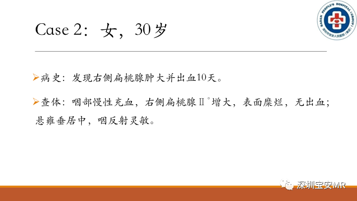 【病例】扁桃体淋巴瘤2例MR影像