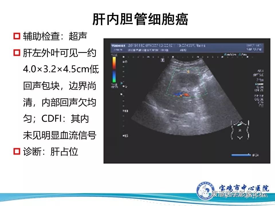【病例】不典型肝血管瘤1例CT及MR影像