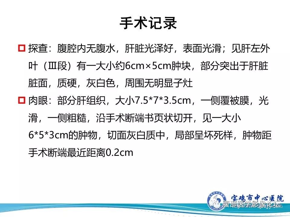 【病例】不典型肝血管瘤1例CT及MR影像