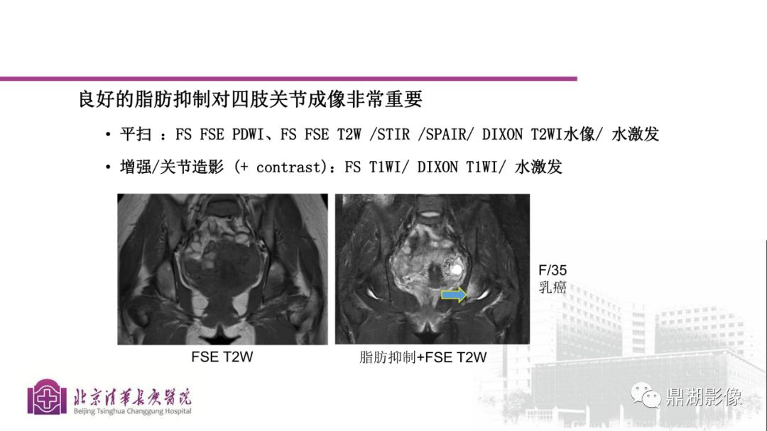 【PPT】四肢肌骨成像MRI扫描技术