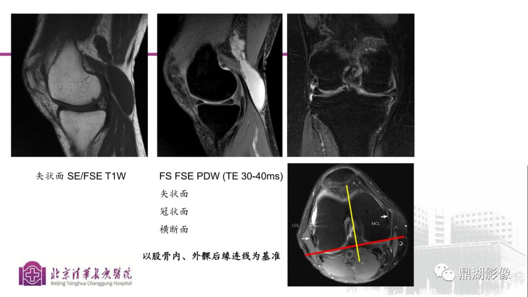 【PPT】四肢肌骨成像MRI扫描技术