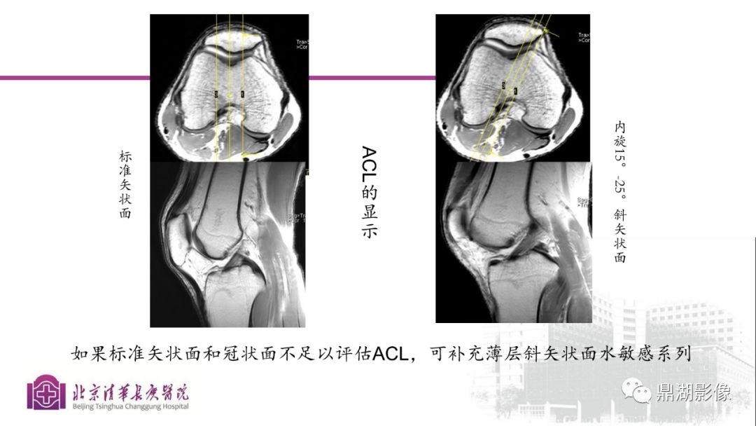 【PPT】四肢肌骨成像MRI扫描技术