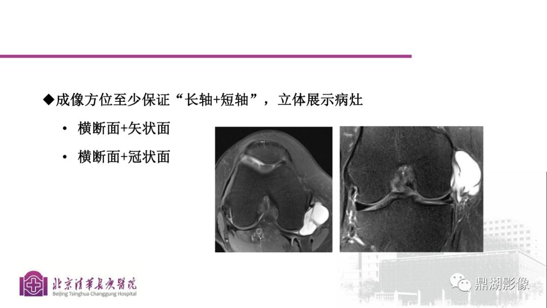 【PPT】四肢肌骨成像MRI扫描技术