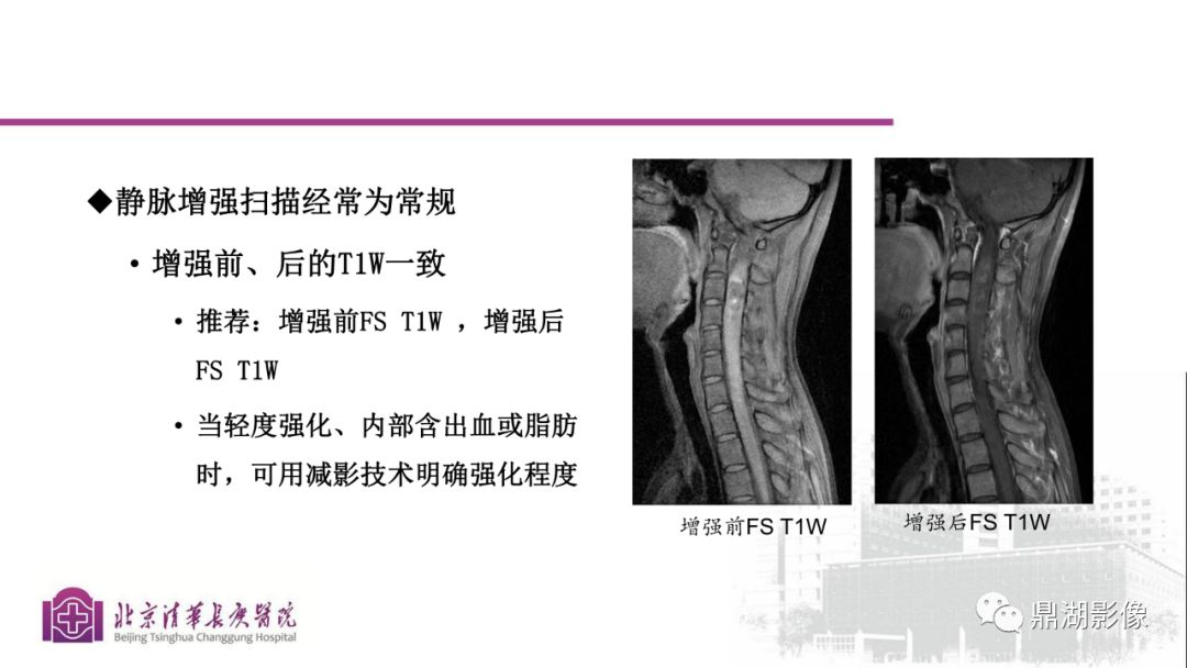【PPT】四肢肌骨成像MRI扫描技术