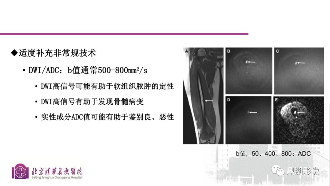 【PPT】四肢肌骨成像MRI扫描技术