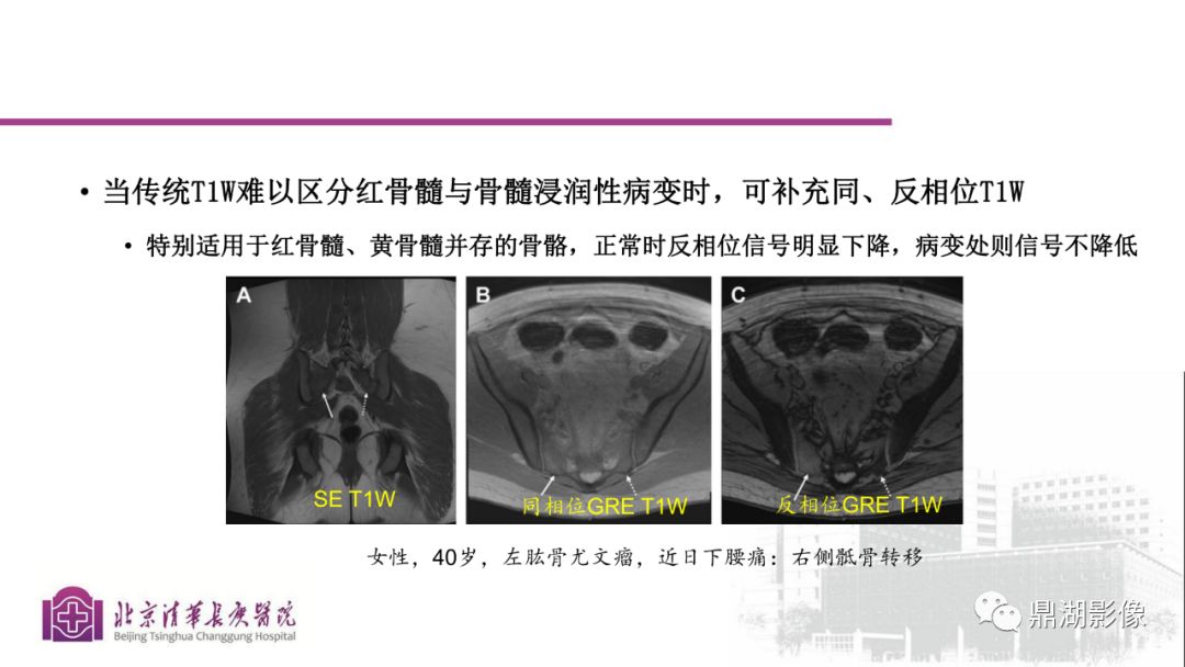 【PPT】四肢肌骨成像MRI扫描技术