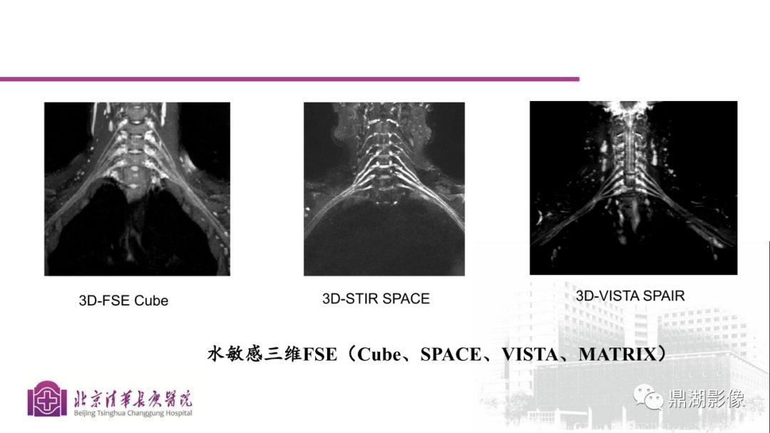 【PPT】四肢肌骨成像MRI扫描技术
