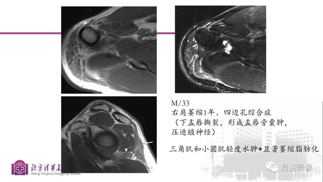 【PPT】四肢肌骨成像MRI扫描技术