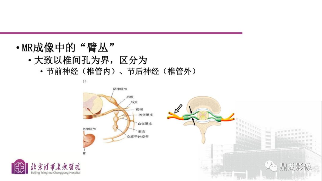 【PPT】四肢肌骨成像MRI扫描技术