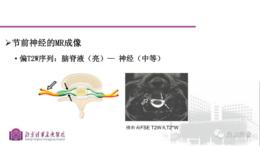 【PPT】四肢肌骨成像MRI扫描技术