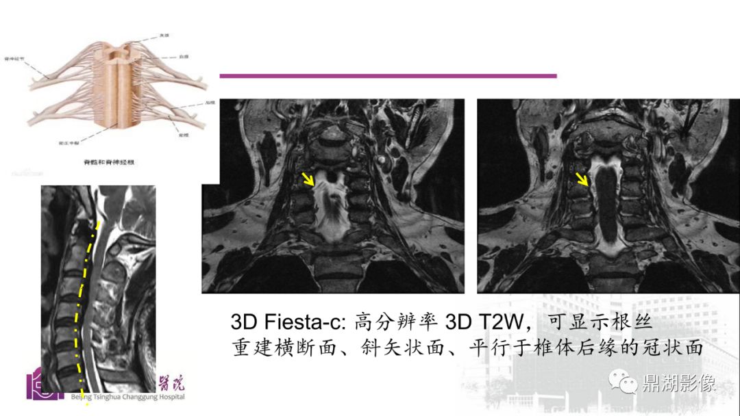 【PPT】四肢肌骨成像MRI扫描技术