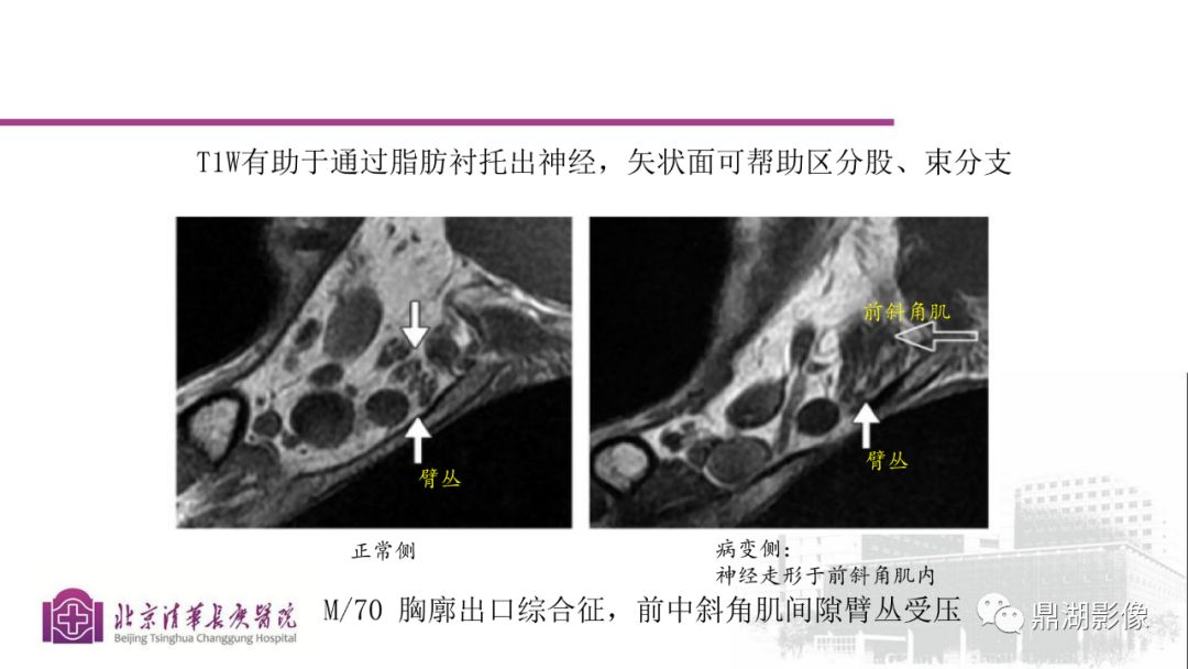 【PPT】四肢肌骨成像MRI扫描技术