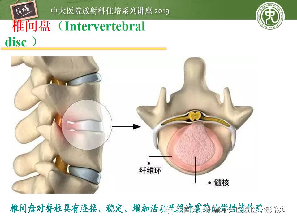 【PPT】椎间盘病变的影像分型及评价