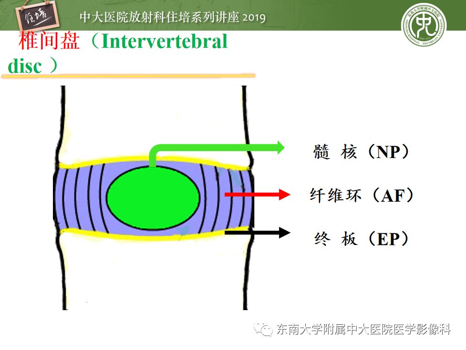 【PPT】椎间盘病变的影像分型及评价
