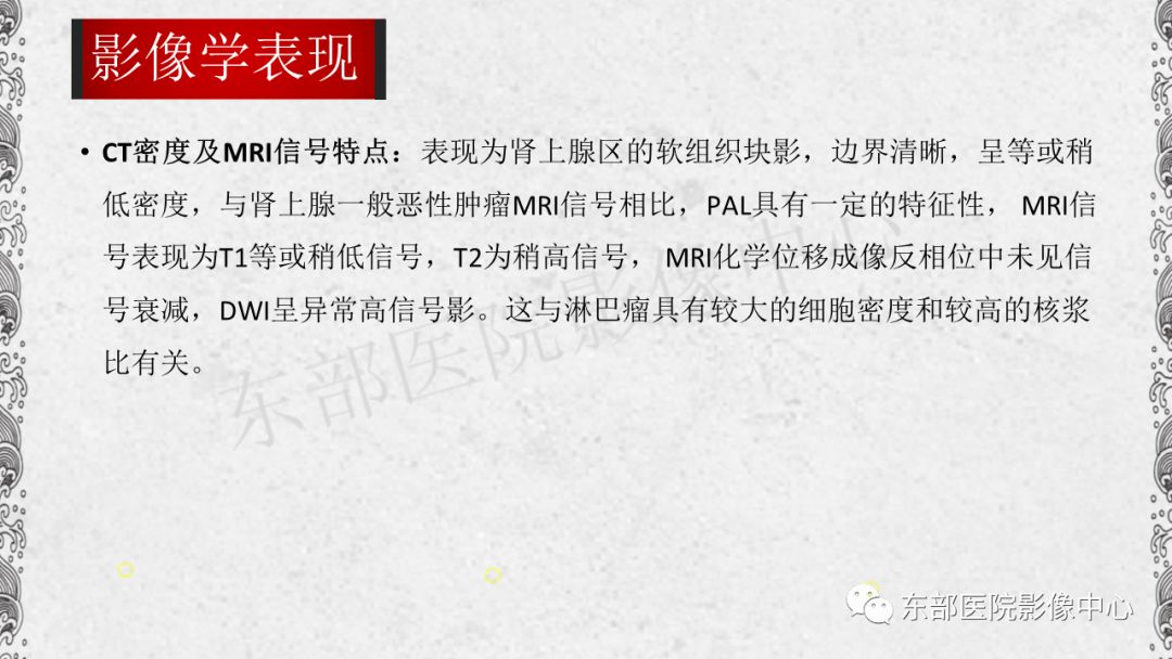 【PPT】肾上腺淋巴瘤
