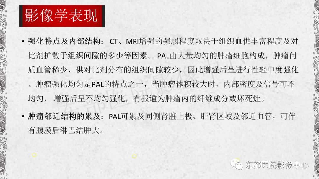 【PPT】肾上腺淋巴瘤