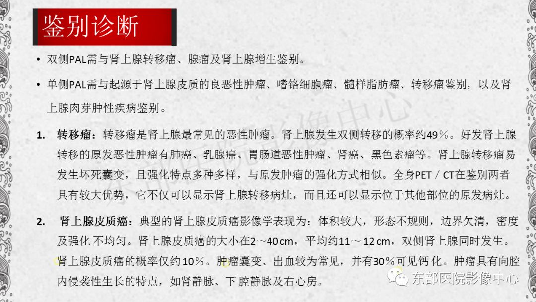 【PPT】肾上腺淋巴瘤