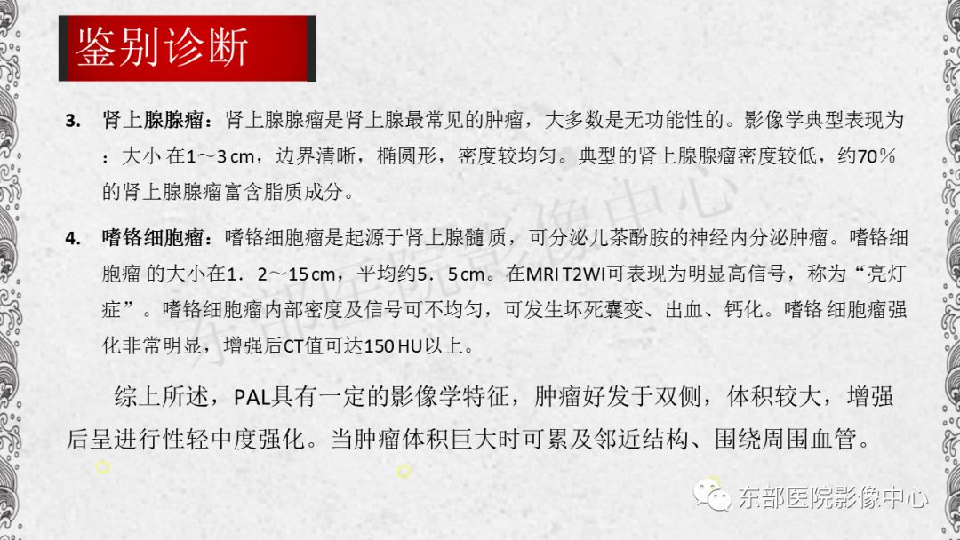 【PPT】肾上腺淋巴瘤