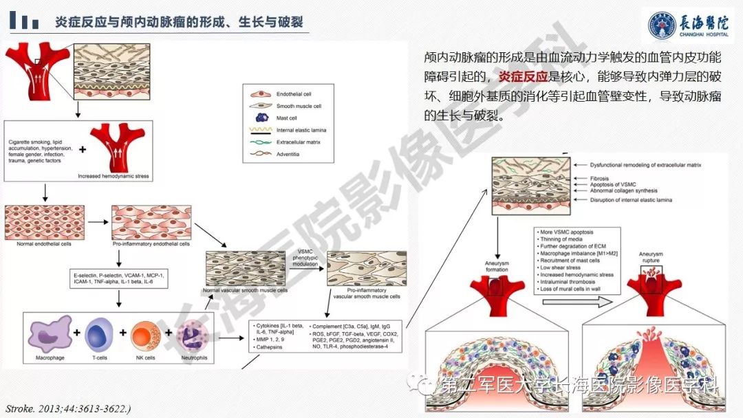 【PPT】高分辨率MRI管壁成像在颅内动脉瘤风险评估中的应用