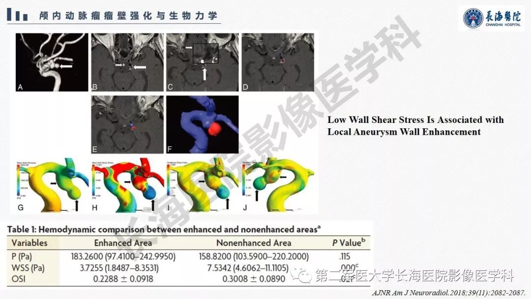 【PPT】高分辨率MRI管壁成像在颅内动脉瘤风险评估中的应用