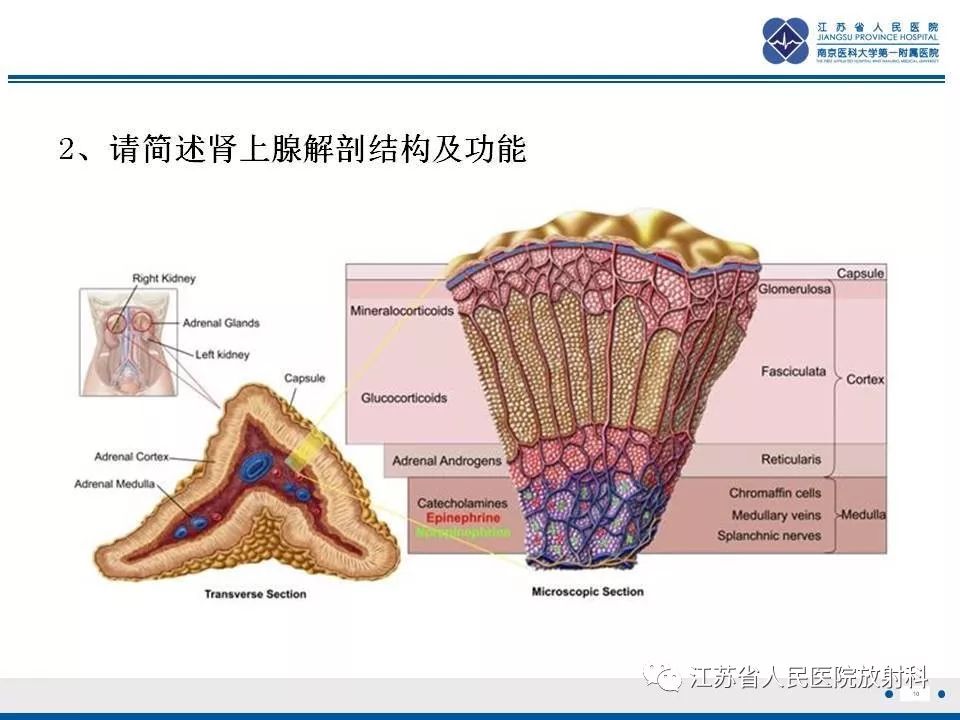 【PPT】肾上腺血管瘤