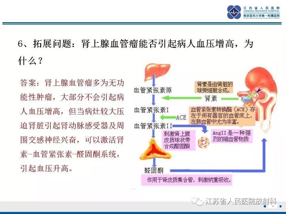 【PPT】肾上腺血管瘤