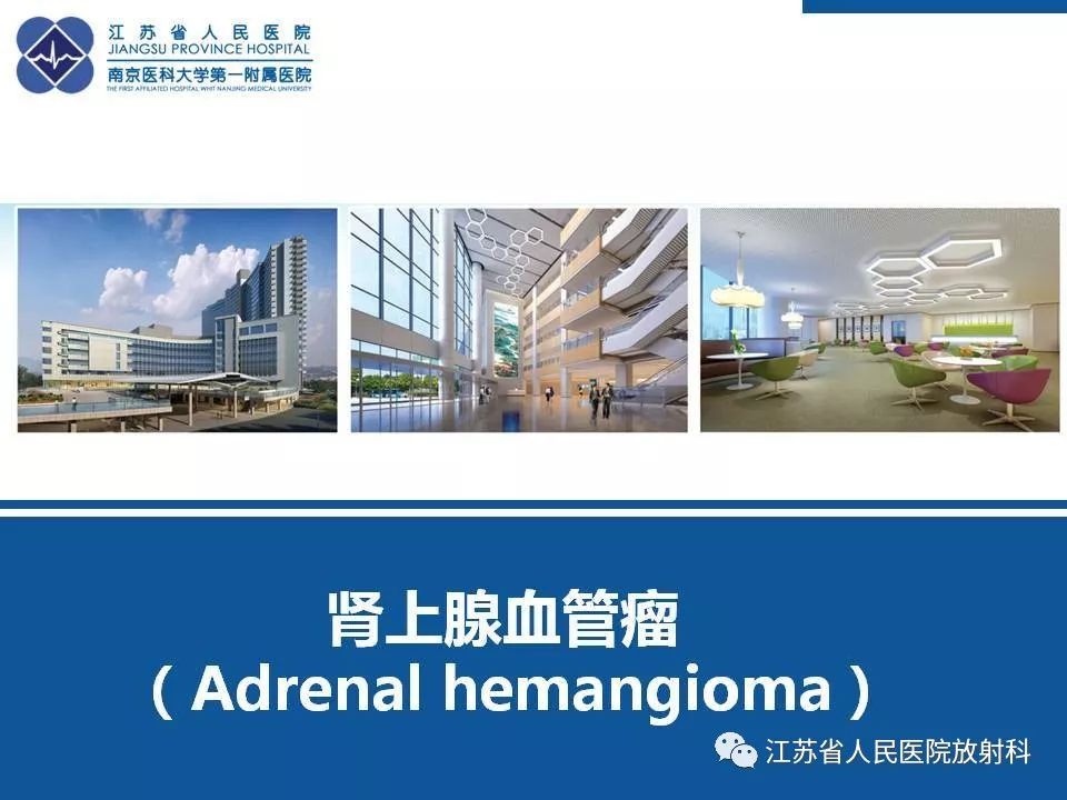 【PPT】肾上腺血管瘤