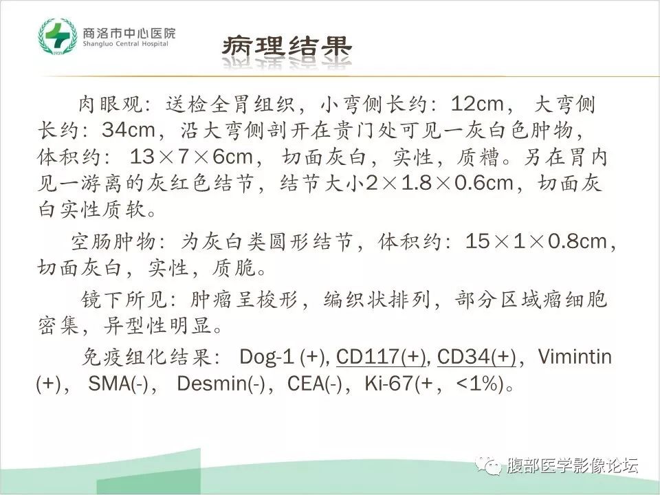 【病例】胃部胃肠道间质瘤1例X线CT影像